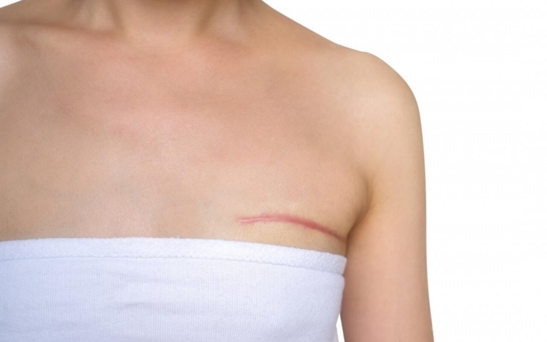 Outubro Rosa: saiba mais sobre o câncer de mama