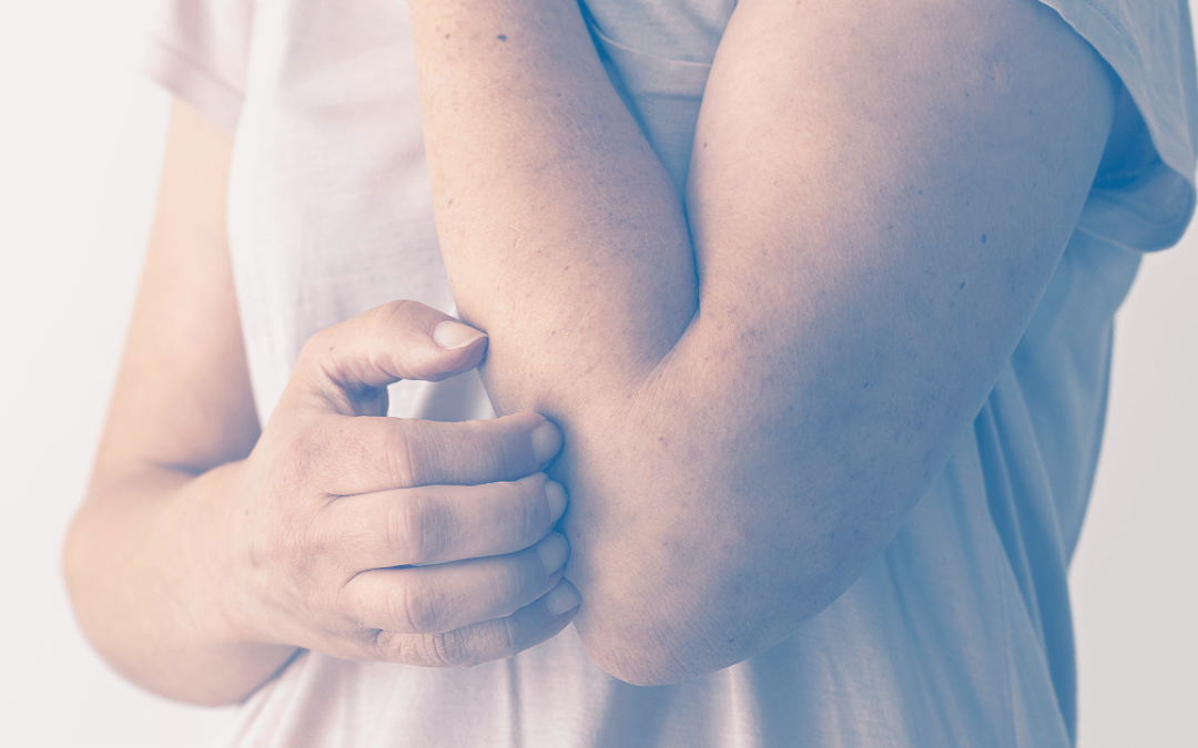 Tratamento de Ceratoses