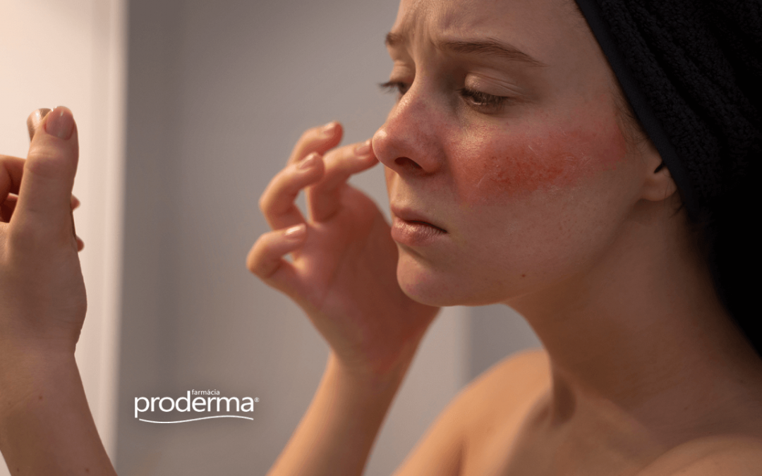 Rosácea: conheça as causas, tratamento e produtos indicados